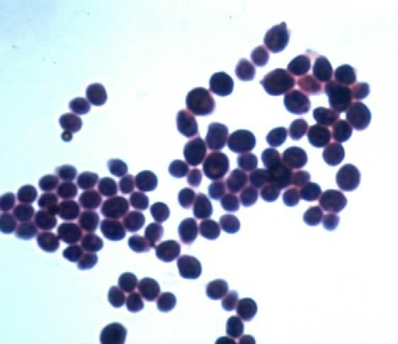 Staphylococcus Photo: archive