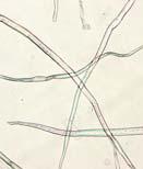 Cellulose microfibrils 4-5
