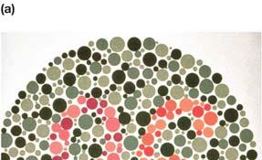 Sex Linked Genes Genes on X chromosome Example Red-Green Color Blindness Two Alleles
