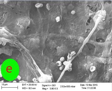 62 * Value in parenthesis representing arc sin transformed value Fig 1: SEM studies of mycoparasitism a Coiling and