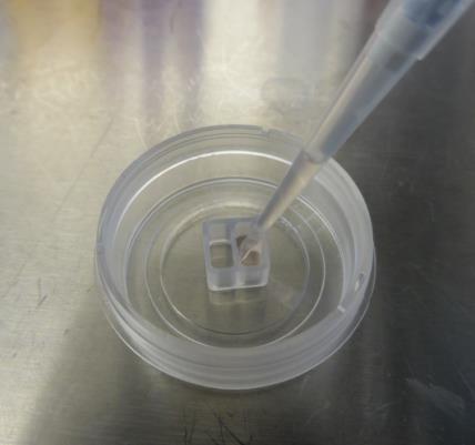 2. Material Cells: MCF-7 (ATCC: HTB-22; DSMZ: ACC115) ibidi Labware: Culture-Insert 2 Well in µ-dish 35 mm, high (ibidi, 80206) Cell culture surface: ibitreat Cell culture medium: RPMI (Sigma, R8758)