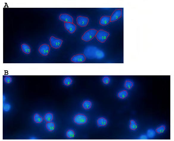Figure 2. Image Pro Plus analysis of neurons in culture. Neurons stained with DAPI were digitally imaged under UV-fluorescence.