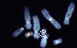 What does genetic modification mean? Genes on a chromosome. Chromosomes are made up of genes.