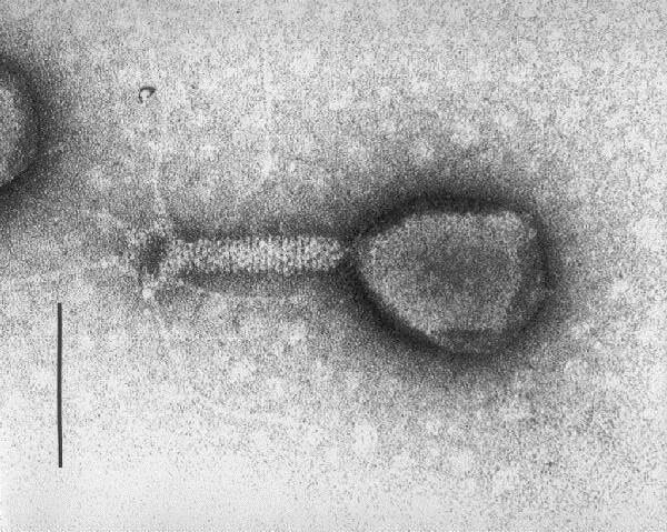 substrate Stain in excess Fig 9-54 Bacteriophage virus Gene