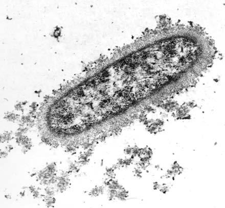Many Pathogenic Bacteria are Encapsulated with Polysaccharides
