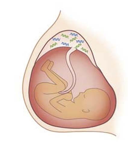 Development of non-invasive prenatal diagnosis at WMRGL Invasive C.V.S.