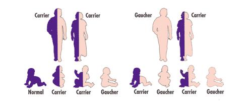 Gaucher Disease Gaucher Disease is a rare, genetic disease.
