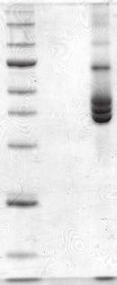 b, Two electrophoresis steps to identify the bacterial glutamine transamidosome.