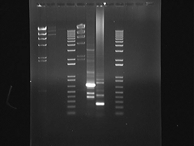 Methods for DNA analysis Fragments are stained with Ethidium Bromide for observation Useful in