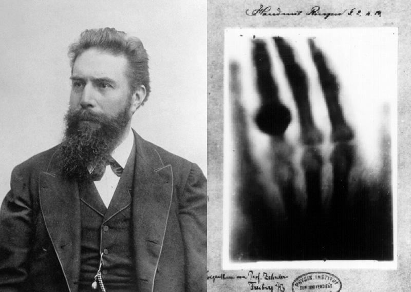 Discovery of X-Rays Wilhelm Conrad Röntgen Rontgen's first x ray image.