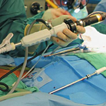 experienced surgical clinicians, observe cases, and practice the procedure on simulators.