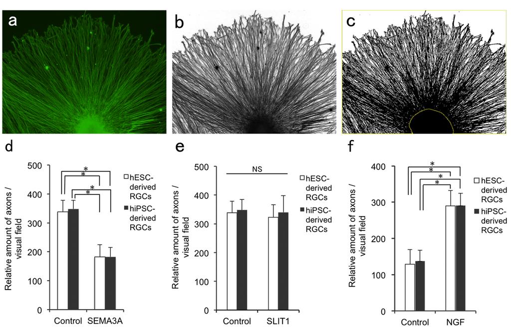 Figure S5 Figure S5. Quantification of the effect of the agents supplementation on axonal growth of hesc- and hipsc-derived RGCs.