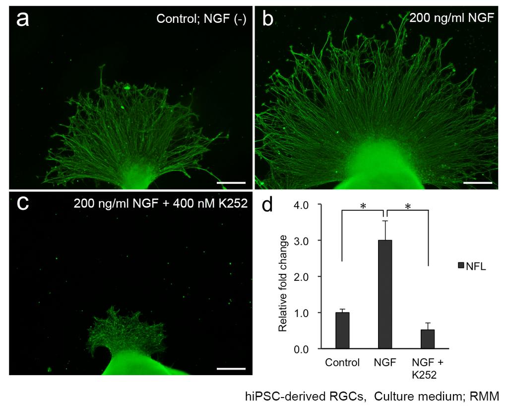 Figure S6 Figure S6. Effect of NGF and K252 supplementation on axonal growth of hesc-derived RGCs The effect of NGF and its inhibitor, K252, on axonal growth of hesc- derived RGCs was investigated.