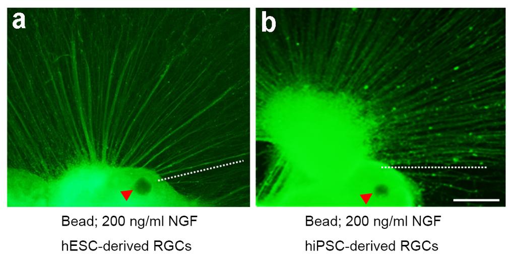 Figure S7 Figure S7. The effect of focally sustained release of NGF on pathfinding of axons of hesc- and hipsc-derived RGCs.