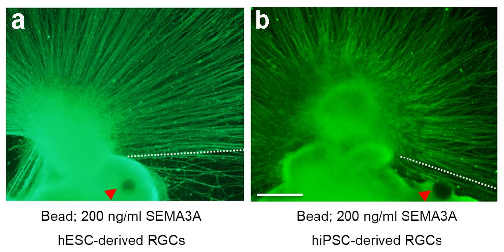 Figure S8 Figure S8. The effect of focally sustained release of SEMA3A on pathfinding of axons of hesc- and hipsc-derived RGCs.