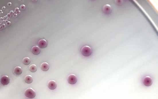 HardyCHROM O157 provides an initial screen intended to isolate colonies for further testing. Confirm isolated purple-pink colonies with a latex agglutination test (Cat. no. PL070HD), antisera (Cat.