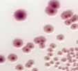 Klebsiella pneumoniae Staphylococcus aureus Citrobacter One