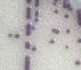 VIBRIO NEW Chromogenic Screening Medium for Vibrio!