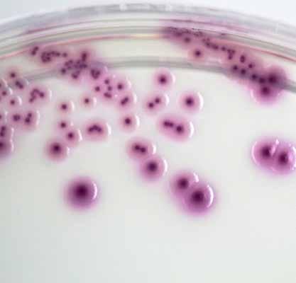 coli can be identified as pink to violetcolored colonies on the plate, while coliform bacteria