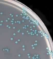 Listeria monocytogenes and Listeria ivanovii will turn turquoise and have white opaque halos.