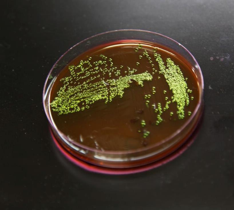 orm is a) green sheen on EMB agar plate, and b) fluorescence from EC+MUG agar plate both inoculated with E. coli.