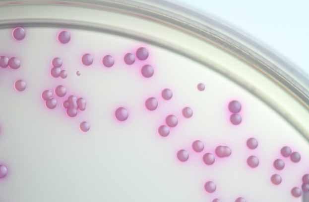 Methicillin-resistant Staphylococcus aureus colonies grown aerobically for 24 hours.