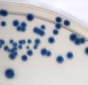 E. coli Enterococcus