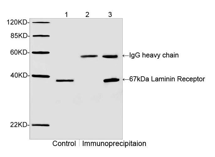 Immunoprecipitation analysis with cell lysates Western blot analysis of extracts from MCF-7 and its immunoprecipitates.