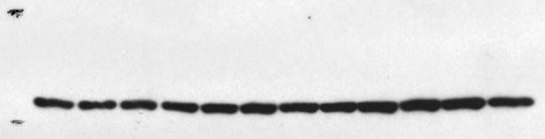 Monoclonal antibody against Human Orc1 was used to detect endogenous as well as GFP-Orc1