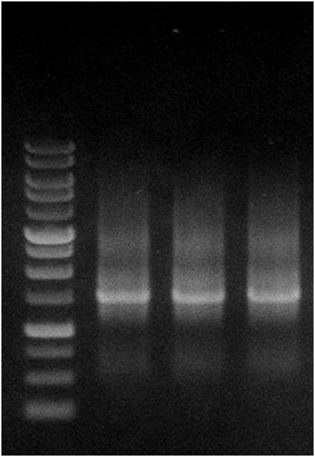 Total DNA was eluted with 50 μl Elution Buffer.