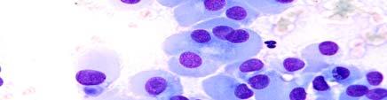 Blood cells result: Nuclei: chromatin: purple Leucocytes: cytoplasm with out ARN: light pink eosinophilic granules: orange brown
