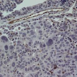 A representative picture of stained lung slides of -treated and