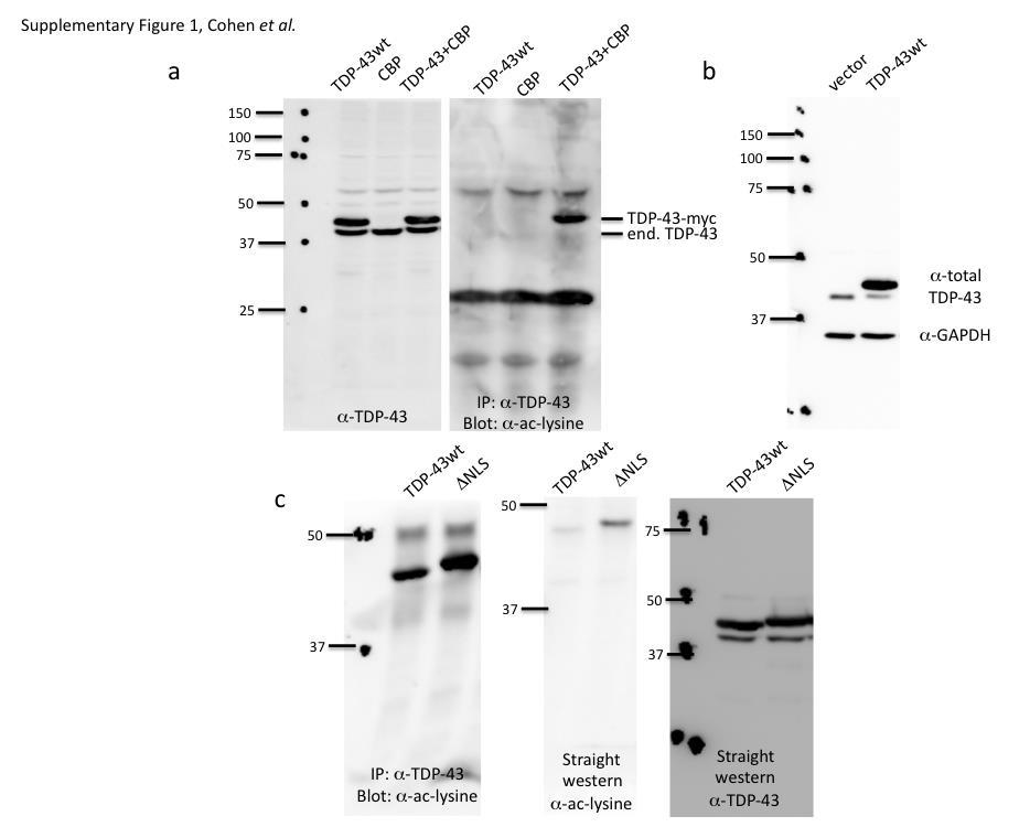 Figure 1: TDP-43 is subject to lysine acetylation within the RNA-binding domain a) QBI-293 cells were transfected with TDP-43 in the presence or absence of the acetyltransferase CBP and acetylated