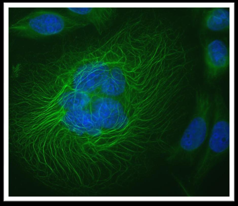 Immuno staining: fluorescent antibodies HeLa cells labeled with nuclear