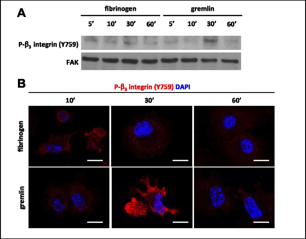 FIGURE S. IX Figure S. IX: Immobilized gremlin induces 3 integrin phosphorylation.