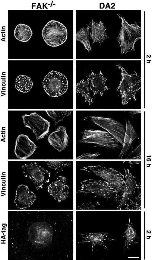 Images at 20 minutes represent a subpopulation of highly spread cells. (B) Immunolocalization of FAK, actin and the focal contact associated protein vinculin in FAK / and DA2 fibroblasts.