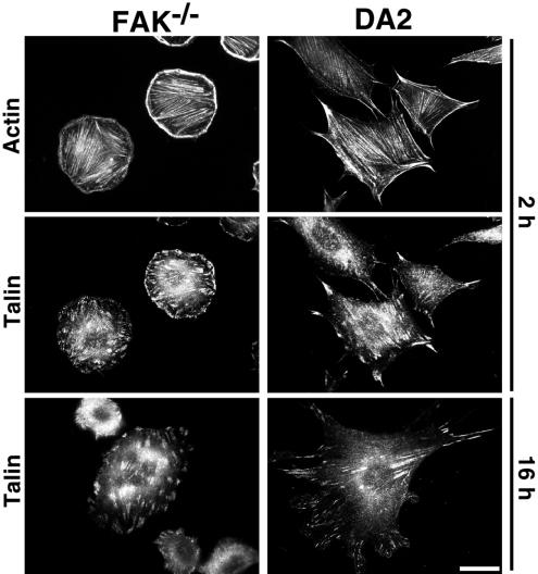 Vinculin positive patches in the DA2 cells appeared extended, but showed no gross difference in their distribution compared to the FAK cells.