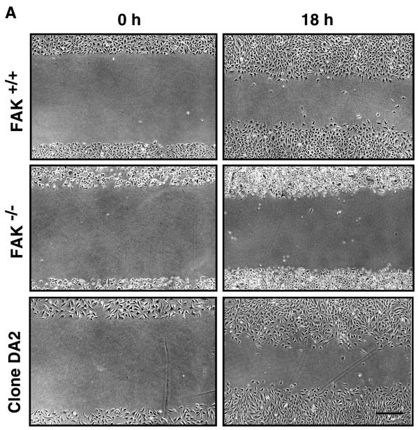 FAK promotes cell migration 2683 healing scratch assays were performed to determine whether stable HA-FAK expression would also reverse the migration defects of the FAK cells (Fig.