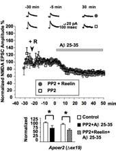 Currents Reversal of Aβ Induced Suppression of