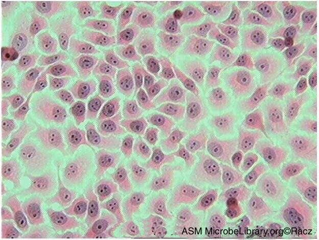 This picture shows the uninfected Vero cell line at 48 h after seeding of the culture.