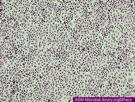 This picture shows uninfected Vero cell line.