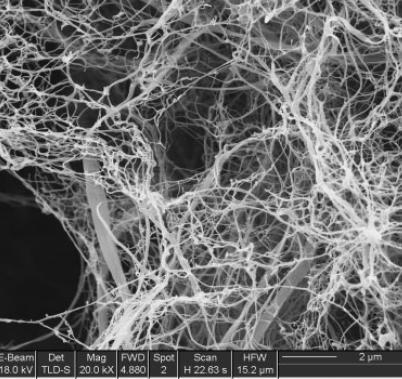 Månson Nanofibrillated cellulose composite hydrogel for the replacement of the nucleus pulposus