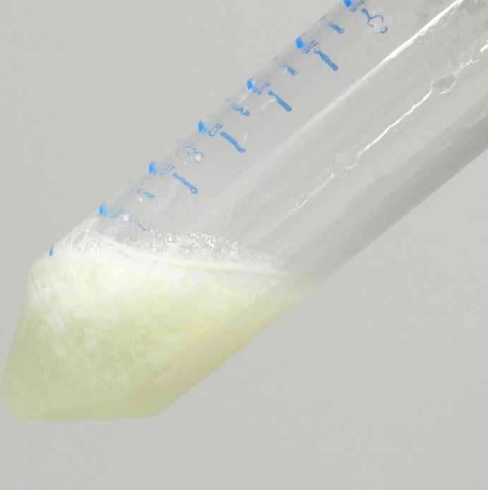 Neutralization Add 300 µl of PD3 Buffer then mix immediately by inverting the tube 10 times. Do not vortex to avoid shearing the genomic DNA.