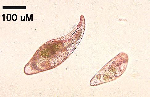 Protozoa Greek for little animal Pathogens include Cryptosporidium Giardia 1976 : First discovered that Cryptosporidium