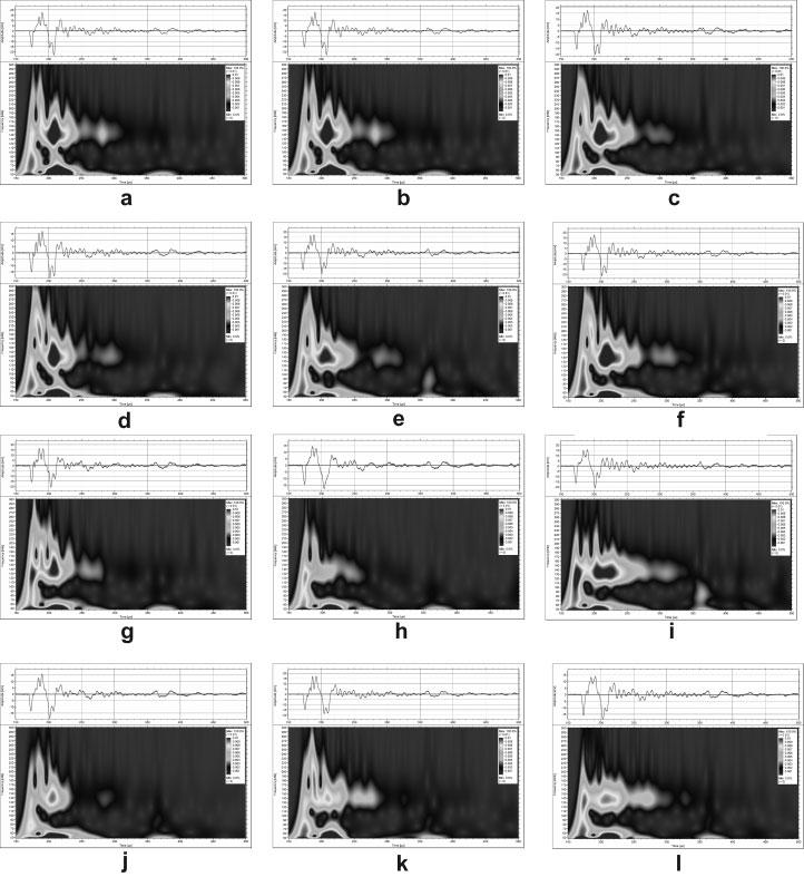 2132 VARGHESE AND CETINKAYA Figure 8. Time frequency spectrograms of the LIP shockwaves excited defect-free tablets (a f) and the tablets with defect type H (g l). acoustic excitation source.