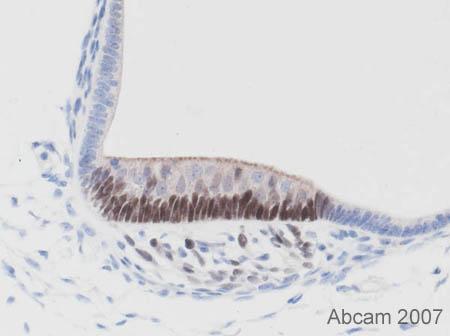 Carl Hobbs, KCL, UK Immunohistochemistry (Formalin/PFA-fixed paraffin-embedded sections) - SOX2 antibody - Embryonic Stem Cell Marker (ab15830) Immunohistochemistical staining (Formaldehyde/PFA-fixed
