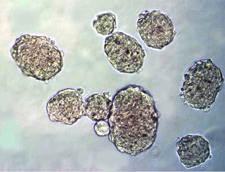 Figure 4: HeLa Colony Formation. HeLa cells were cultured for 10 days according to the assay protocol. Calculation of Anchorage-Independent Growth 1.