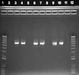 Expected Results Results Plasmid DNA was isolated in duplicates from E. coli (TOP10) transformed with pcdna 3.
