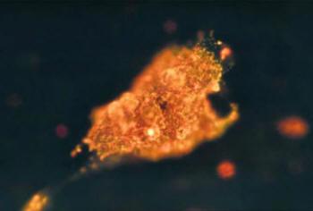 Cancer cell illuminated by gold