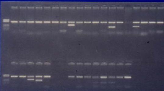 DNA-Isolation PCR-SSP - Workflow PCR with sequencespecific Primercombinations P1 P2 P3 P4 P5 P6